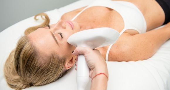 Picture of Micro Needling Rejuvenation 4 treatments – Perth